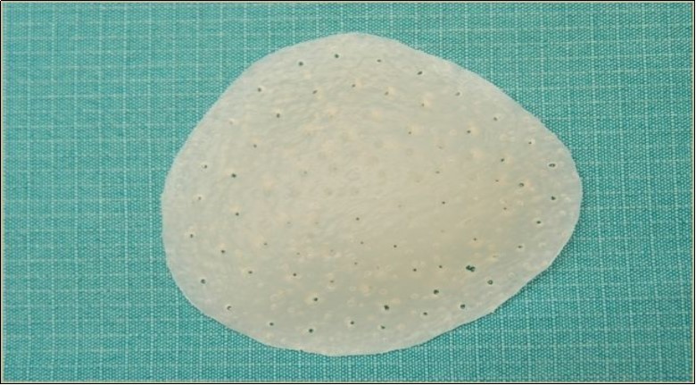 prosthesis