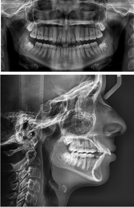 Journal of Dentistry And Oral Implants-Orthodontic implants