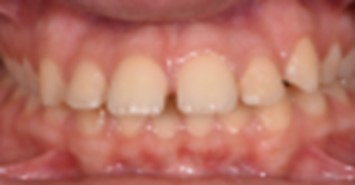 Journal of Dentistry And Oral Implants-Orthodontic implants