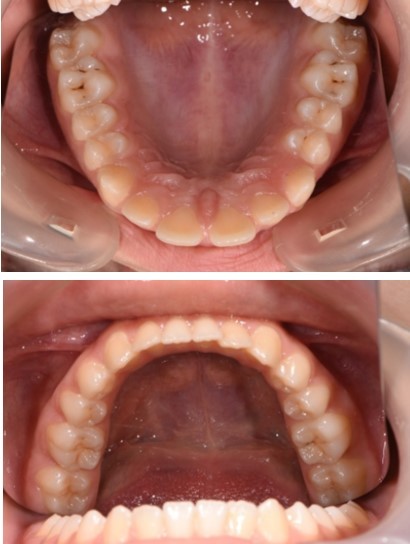 Journal of Dentistry And Oral Implants-Orthodontic implants