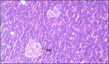 Journal of Bioinformatics And Diabetes-Diabetes mellitus