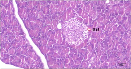 Journal of Bioinformatics And Diabetes-Diabetes mellitus
