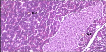 Journal of Bioinformatics And Diabetes-Diabetes mellitus