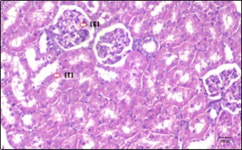 Journal of Bioinformatics And Diabetes-Diabetes mellitus