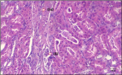 Journal of Bioinformatics And Diabetes-Diabetes mellitus