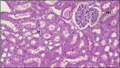 Journal of Bioinformatics And Diabetes-Diabetes mellitus