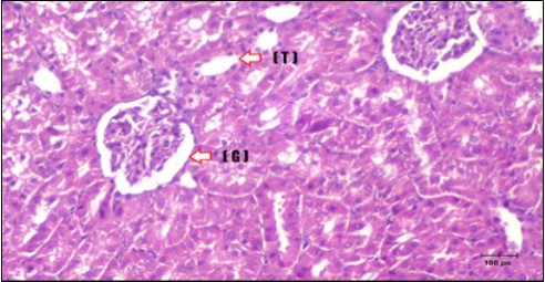 Journal of Bioinformatics And Diabetes-Diabetes mellitus