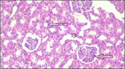 Journal of Bioinformatics And Diabetes-Diabetes mellitus