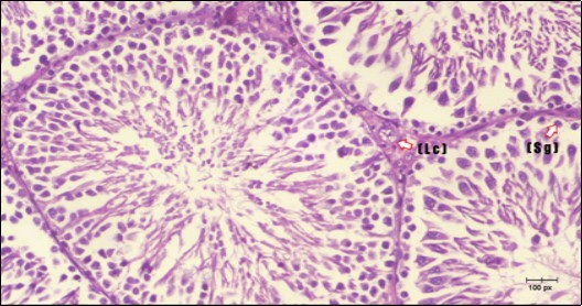 Journal of Bioinformatics And Diabetes-Diabetes mellitus