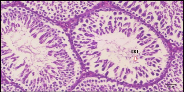 Journal of Bioinformatics And Diabetes-Diabetes mellitus