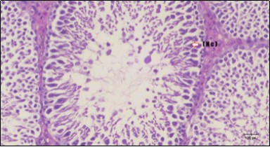 Journal of Bioinformatics And Diabetes-Diabetes mellitus