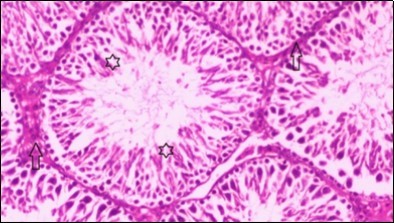 Journal of Bioinformatics And Diabetes-Diabetes mellitus