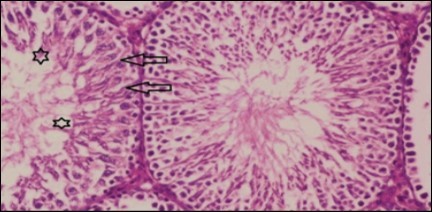 Journal of Bioinformatics And Diabetes-Diabetes mellitus