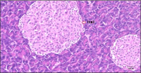 Journal of Bioinformatics And Diabetes-Diabetes mellitus