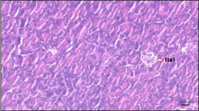 Journal of Bioinformatics And Diabetes-Diabetes mellitus