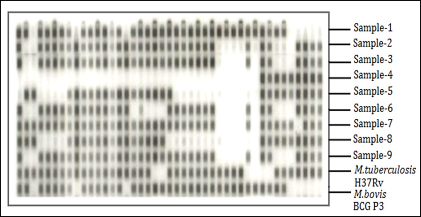 rpoB Gene