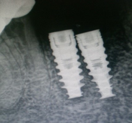 Journal of Dentistry And Oral Implants-periodontal ligament