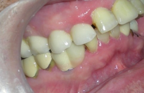 Journal of Dentistry And Oral Implants-periodontal ligament