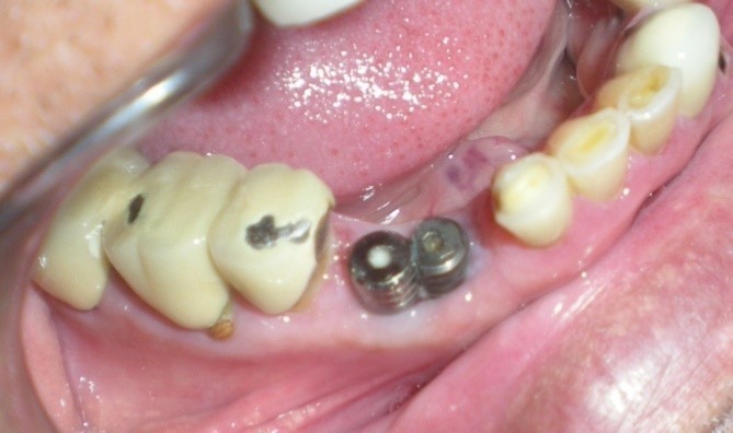 Journal of Dentistry And Oral Implants-periodontal ligament