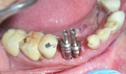 Journal of Dentistry And Oral Implants-periodontal ligament