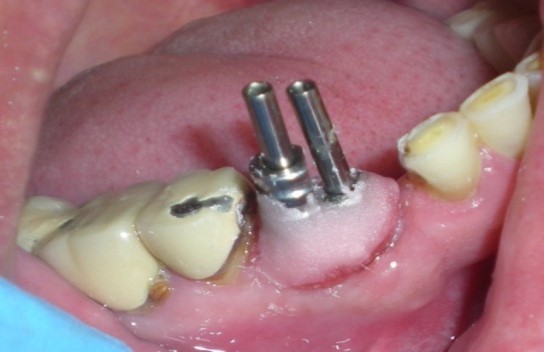 Journal of Dentistry And Oral Implants-periodontal ligament