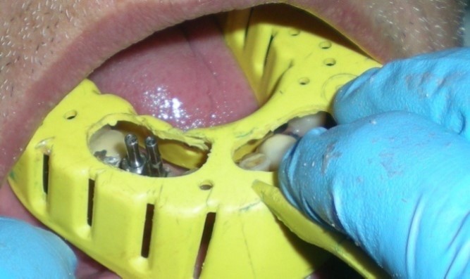 Journal of Dentistry And Oral Implants-periodontal ligament