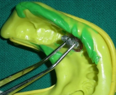 Journal of Dentistry And Oral Implants-periodontal ligament