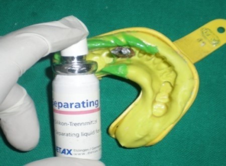 Journal of Dentistry And Oral Implants-periodontal ligament