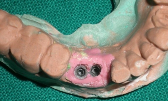 Journal of Dentistry And Oral Implants-periodontal ligament
