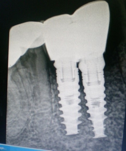 Journal of Dentistry And Oral Implants-periodontal ligament