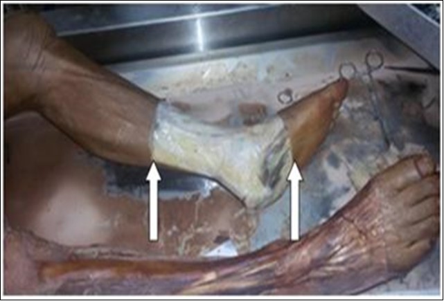 International Journal of Human Anatomy-Anatomy
