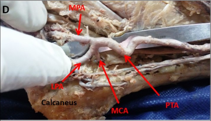 International Journal of Human Anatomy-Anatomy