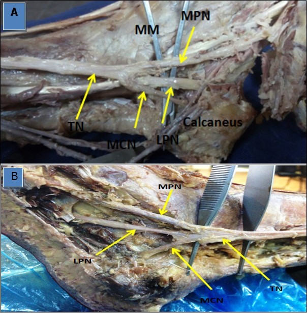 International Journal of Human Anatomy-Anatomy