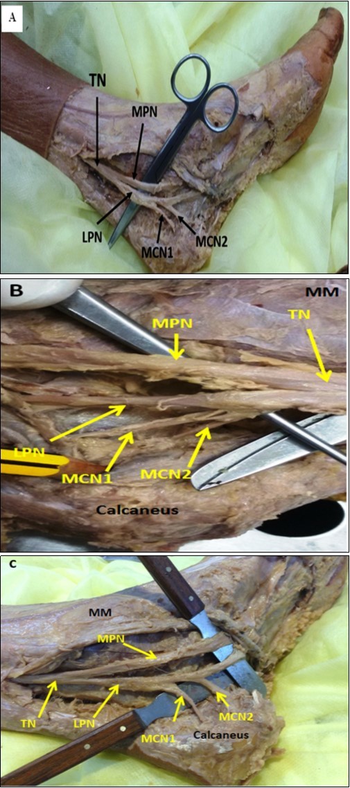 International Journal of Human Anatomy-Anatomy