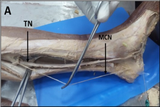 International Journal of Human Anatomy-Anatomy