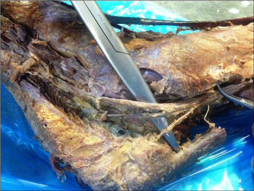 International Journal of Human Anatomy-Anatomy