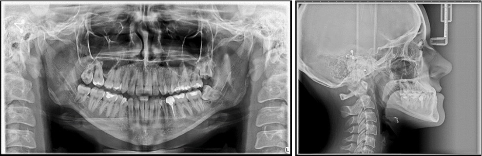 Journal of Dentistry And Oral Implants-sagital skeletal discrepancies
