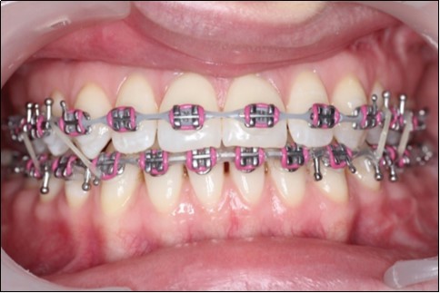 Journal of Dentistry And Oral Implants-sagital skeletal discrepancies