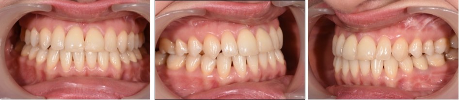 Journal of Dentistry And Oral Implants-sagital skeletal discrepancies