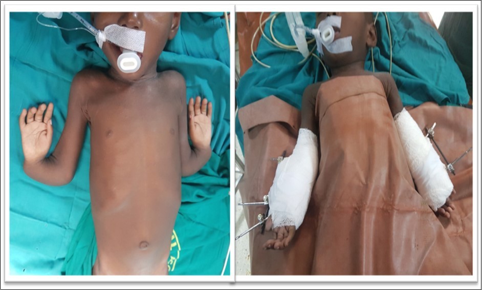 Journal of Preventive Medicine And Care-complex congenital disorder