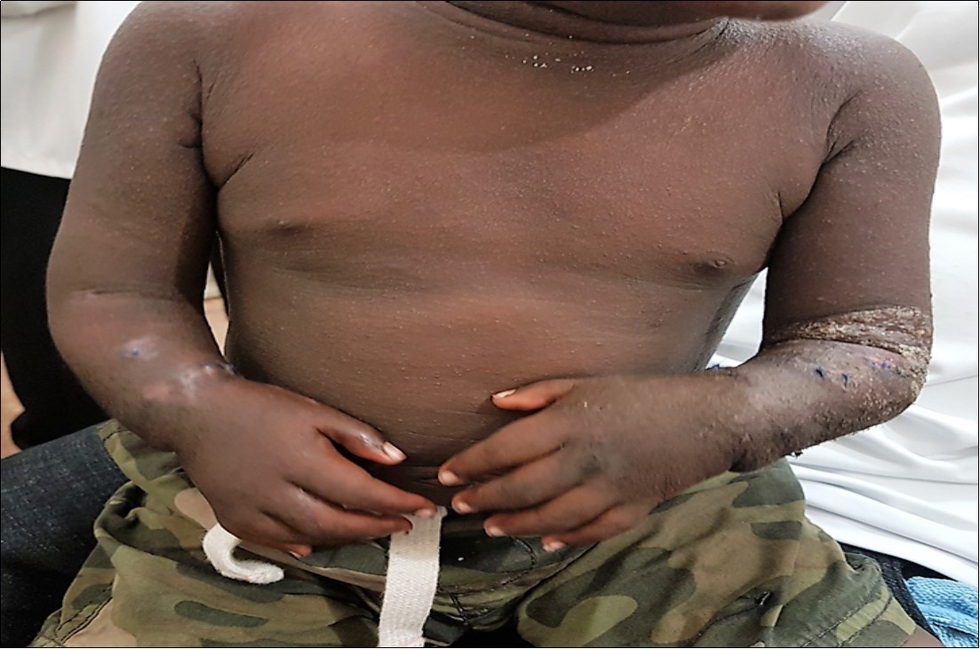 Journal of Preventive Medicine And Care-complex congenital disorder