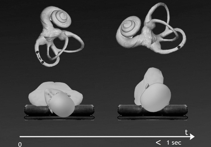 Journal of Otolaryngology Advances-Posterior canal BPPV