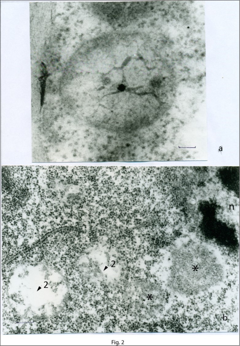 Triticum aestivum L