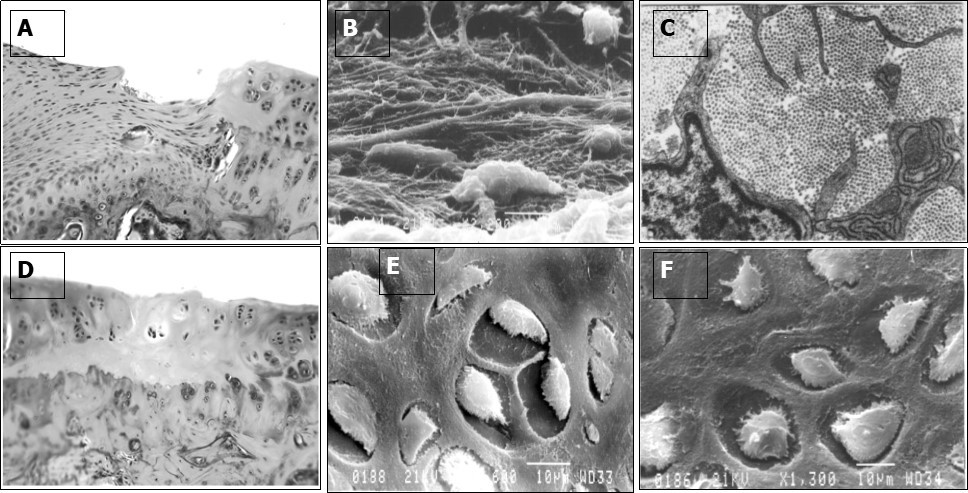 International Journal of Human Anatomy-articular cartilage defect