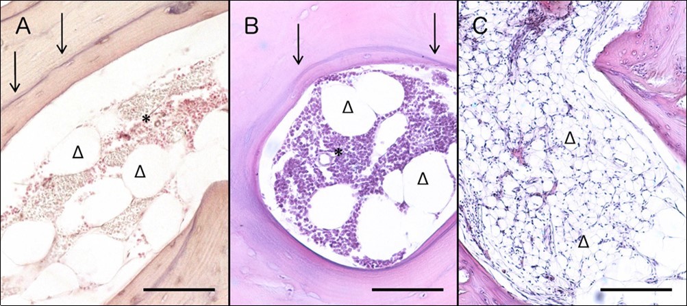 Journal of Hematalogy and Oncology Research-Waldenström Macroglobulinemia