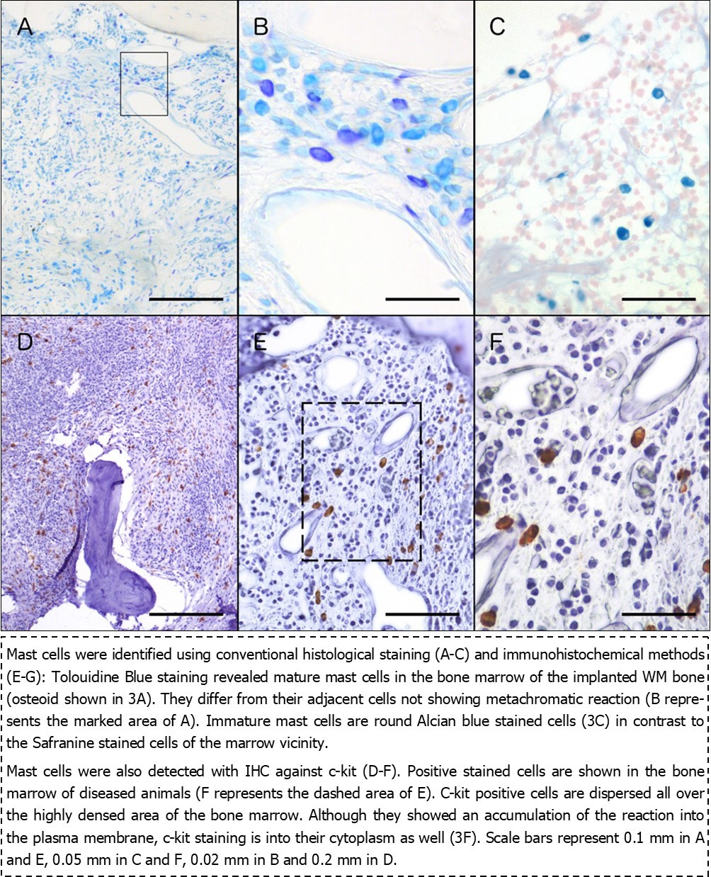 Journal of Hematalogy and Oncology Research-Waldenström Macroglobulinemia