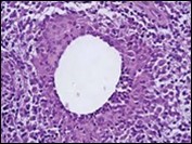 International Journal of Infection Prevention-Chronic