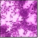 International Journal of Infection Prevention-Chronic