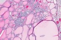International Journal of Infection Prevention-Genetic Multiplicity