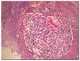 International Journal of Infection Prevention-Genetic Multiplicity